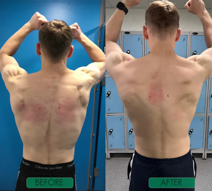 Ostevia™ Posture Corrector