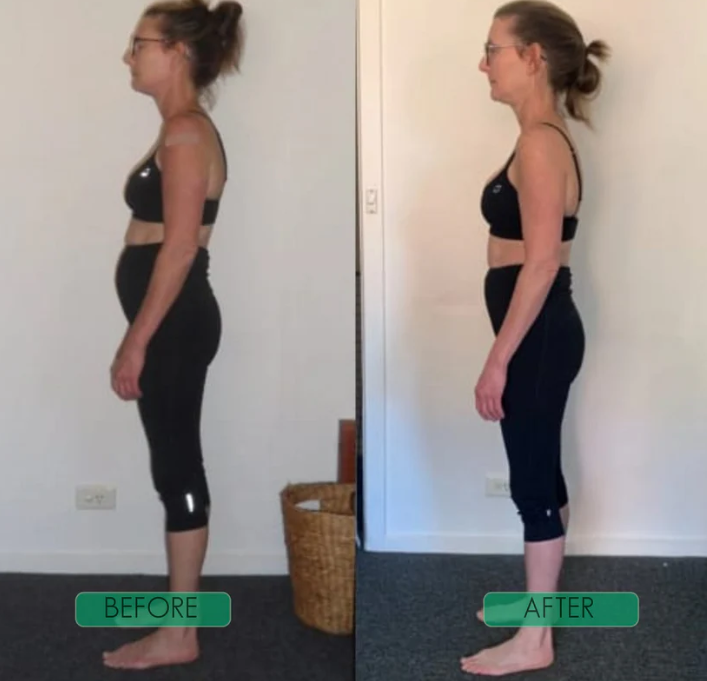 Ostevia™ Posture Corrector