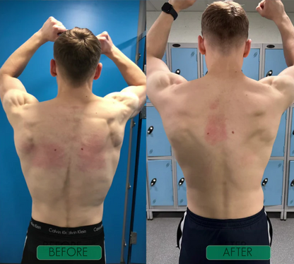 Ostevia™ Posture Corrector