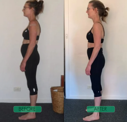 Ostevia™ Posture Corrector
